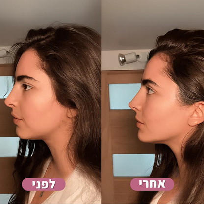 הערכה המקצועית של LA’BELLE לפיסול וחיטוב עור הפנים